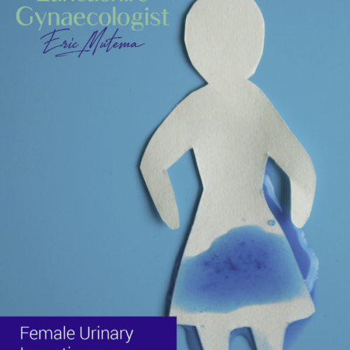 Article about what urinary incontinence